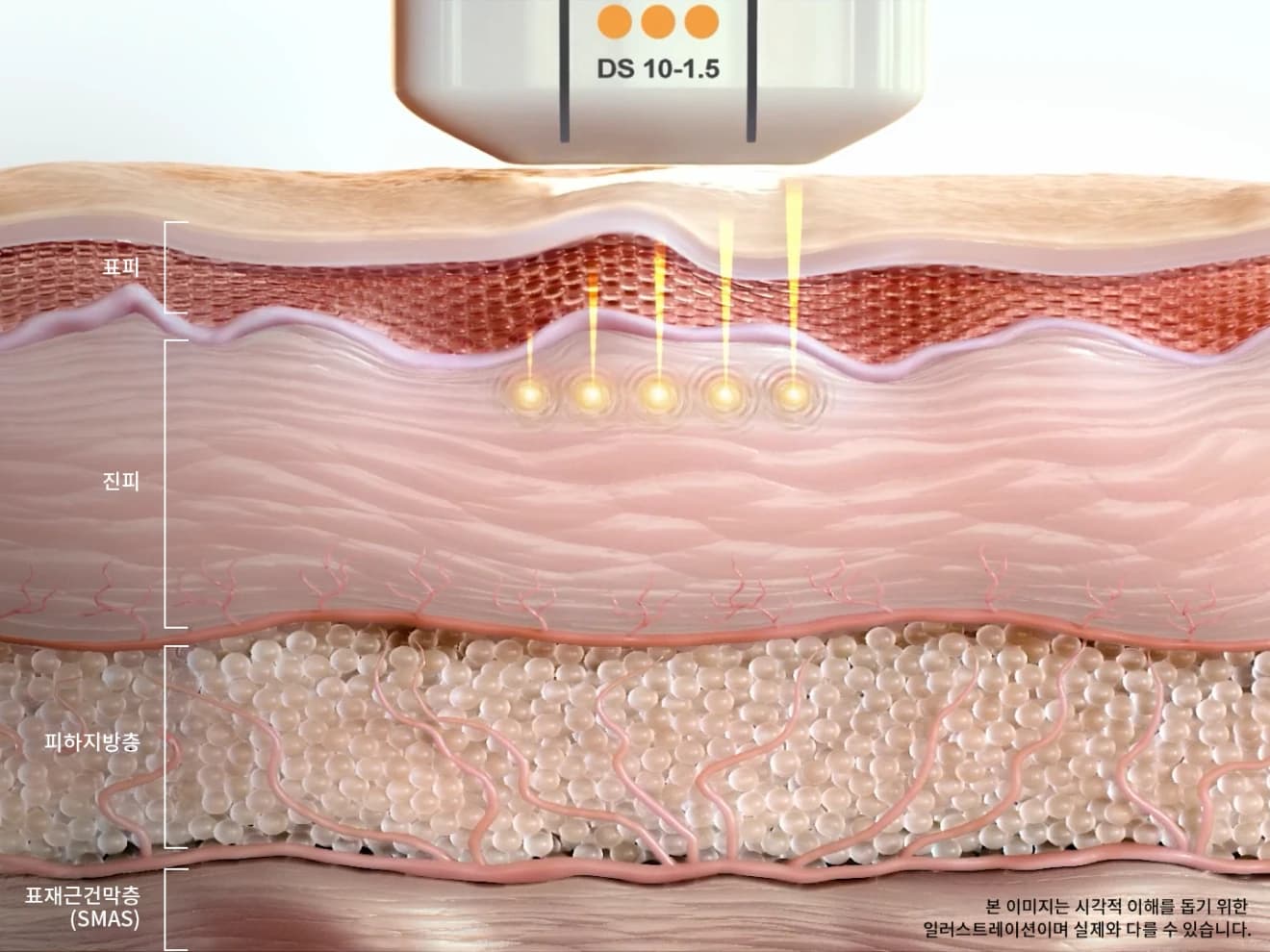 Dr. Eraser Clinic 3