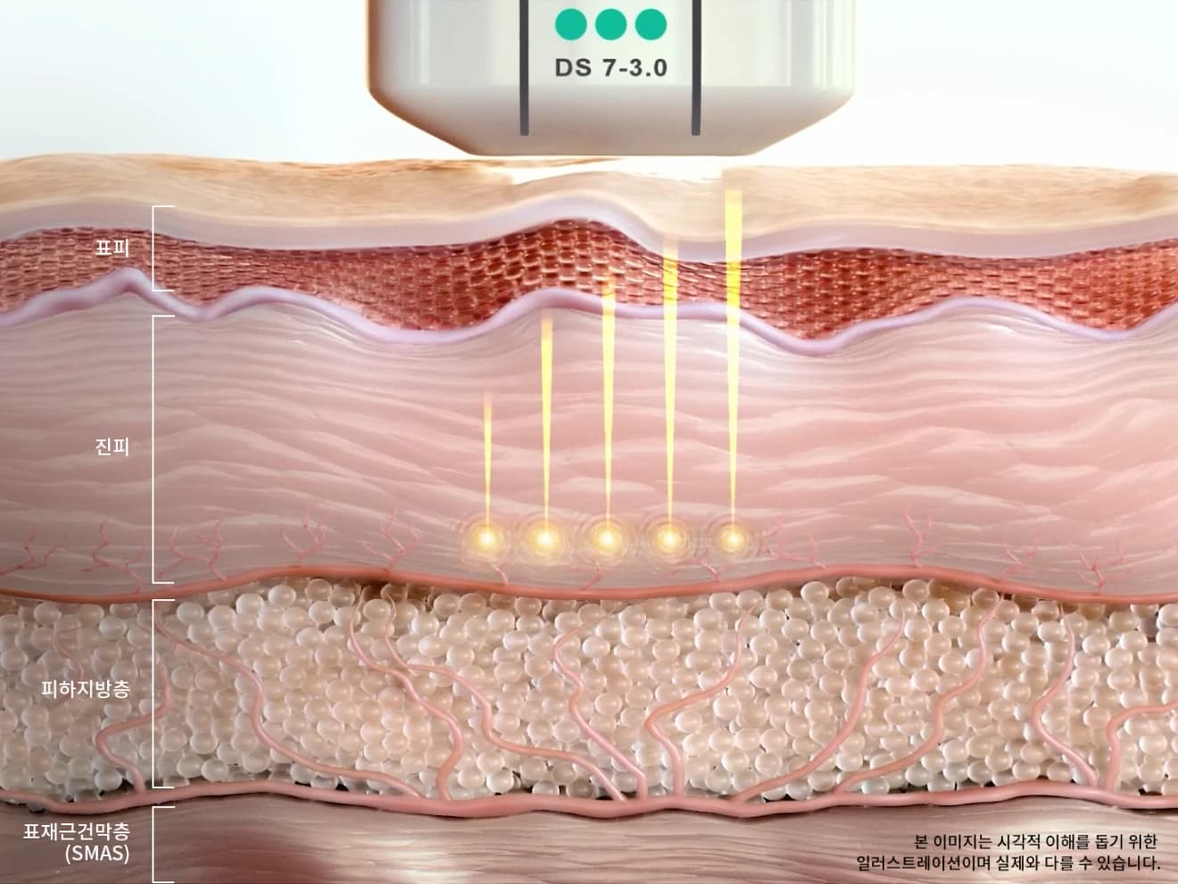 Dr. Eraser Clinic 4